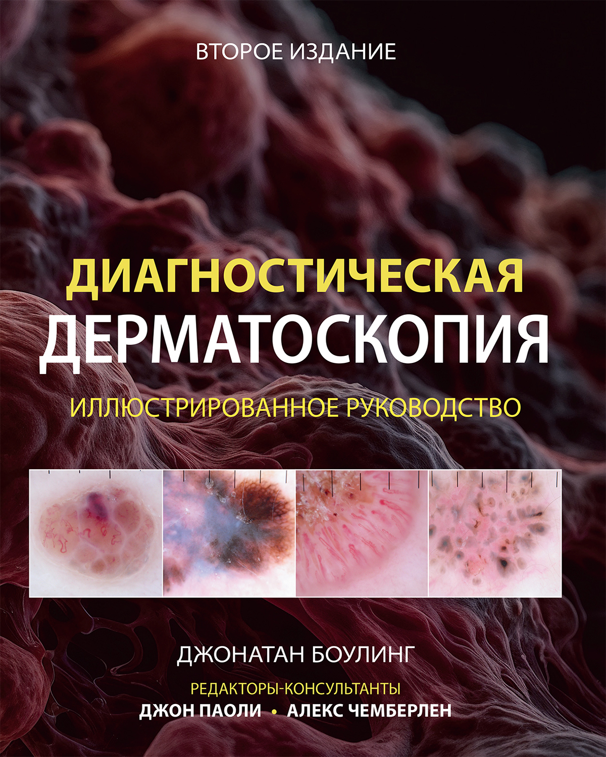 Диагностическая дерматоскопия Диагностическая дерматоскопия